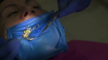 Dişçi kliniğindeki modern ekipmanlar, kanalların kapatılması, ultraviyole taşıyıcı detektörler. yeni