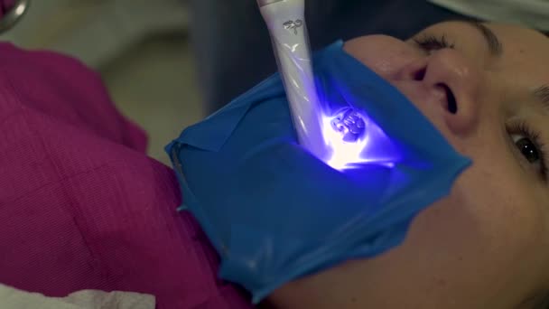 Dentysta Rękawiczkach Medycznych Urządzeniem Ultrafioletowym Ręku Pracuje Pacjentem Utwardzając Wypełnienie — Wideo stockowe
