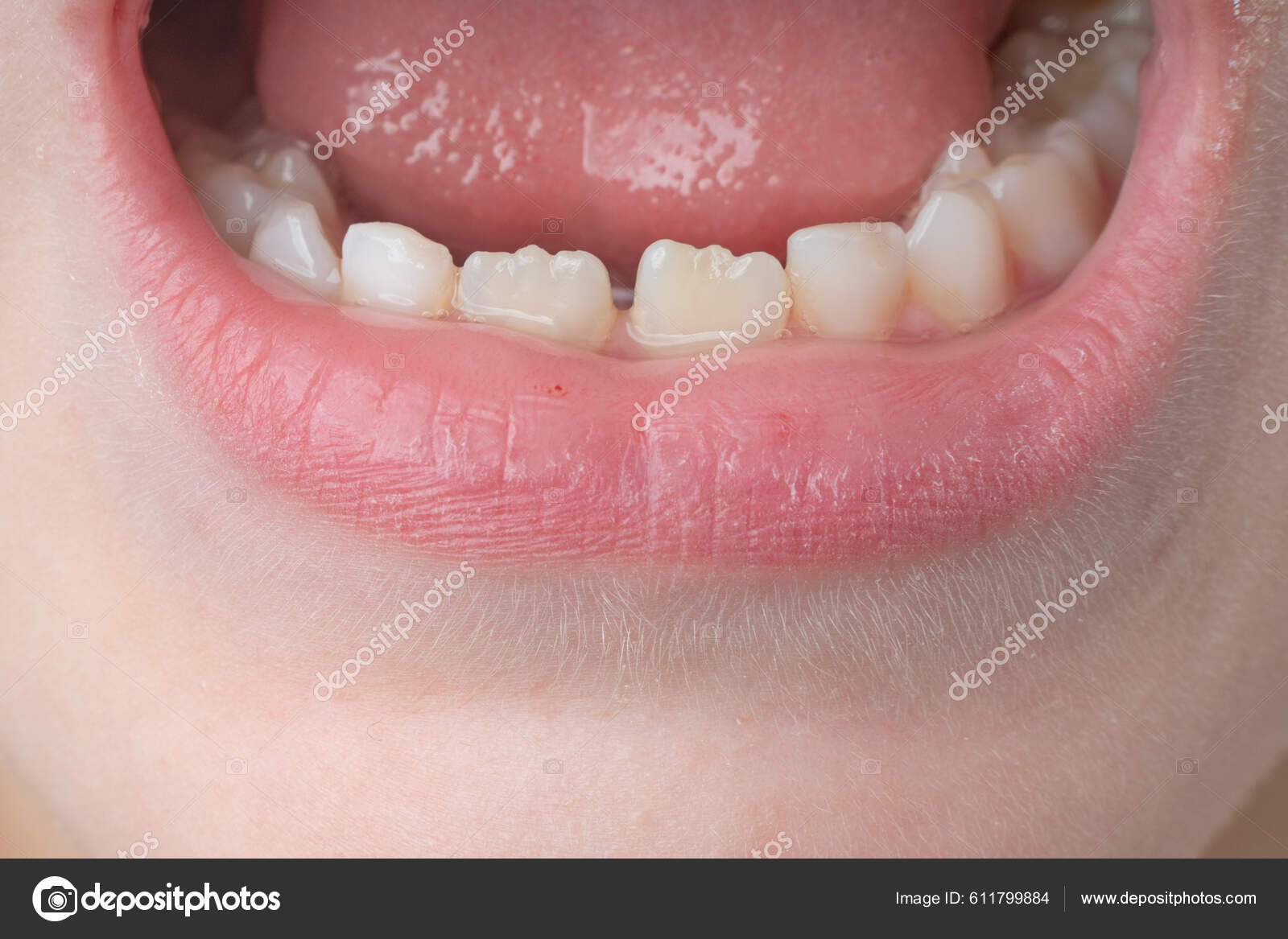 Jaw Child's Even Teeth Close Milk Permanent Teeth Child — 图库照片©NIKO