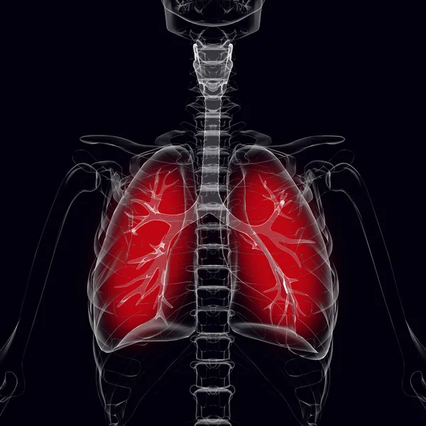 Lungs Highlighted Red Image — Stock Photo, Image