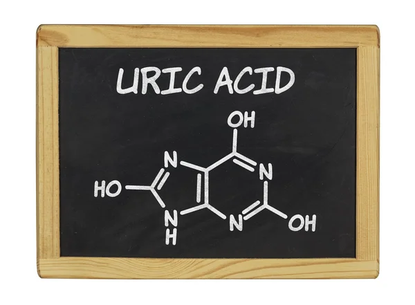 Fórmula química del ácido úrico en una pizarra — Foto de Stock