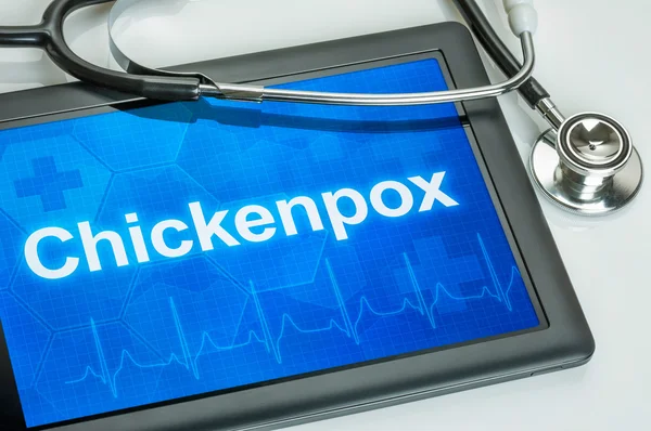 Tablet with the diagnosis Chickenpox on the display — Stock Photo, Image