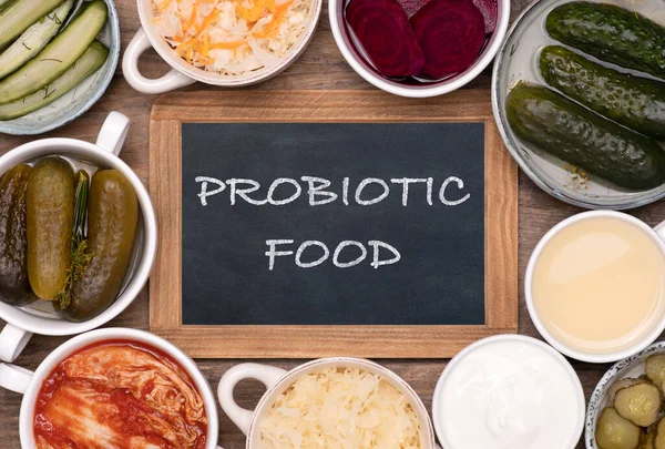 Zdravé Probiotické Fermentované Potraviny Šálcích Miskách Dřevěném Stole Horní Pohled — Stock fotografie