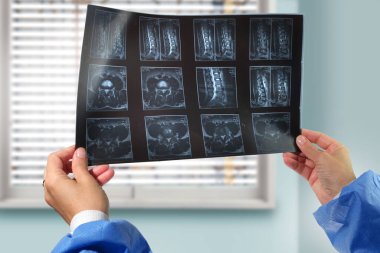 Bir doktor el ele tutuşup omurga röntgenini analiz eder. 