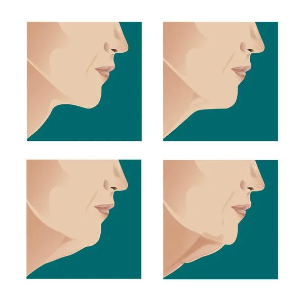 Neck lift — Stock Vector