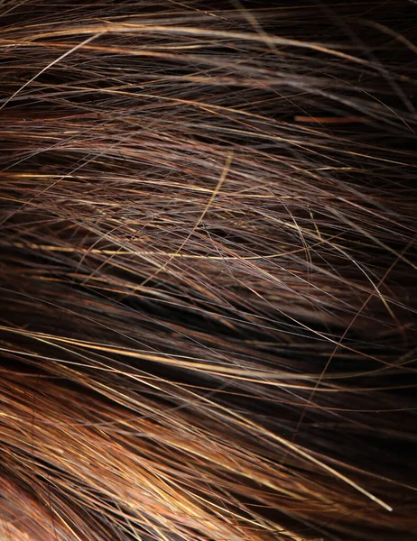 Saç boyalı ve tedaviye ihtiyacı var.