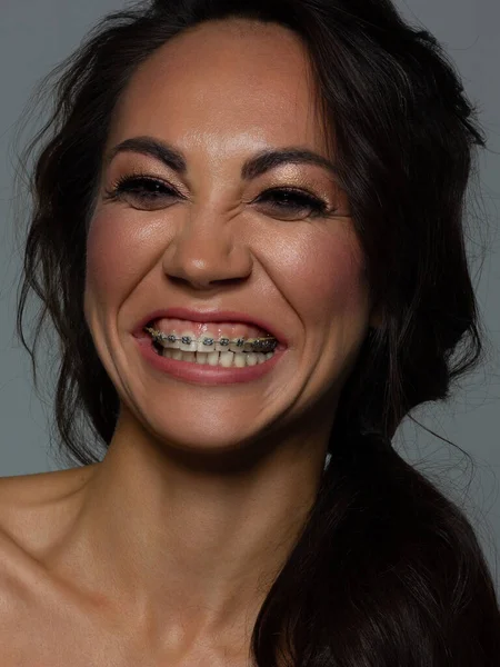 Parlak Pembe Makyajlı Diş Telli Bir Kadının Dudaklarının Yakın Çekimi Stok Fotoğraf