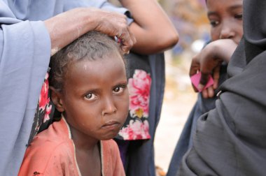 üzgün Afrikalı çocuk. açlık mülteci kampı