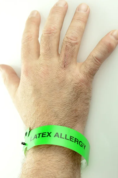 Alergií na latex zápěstí náramek na ruku — Stock fotografie