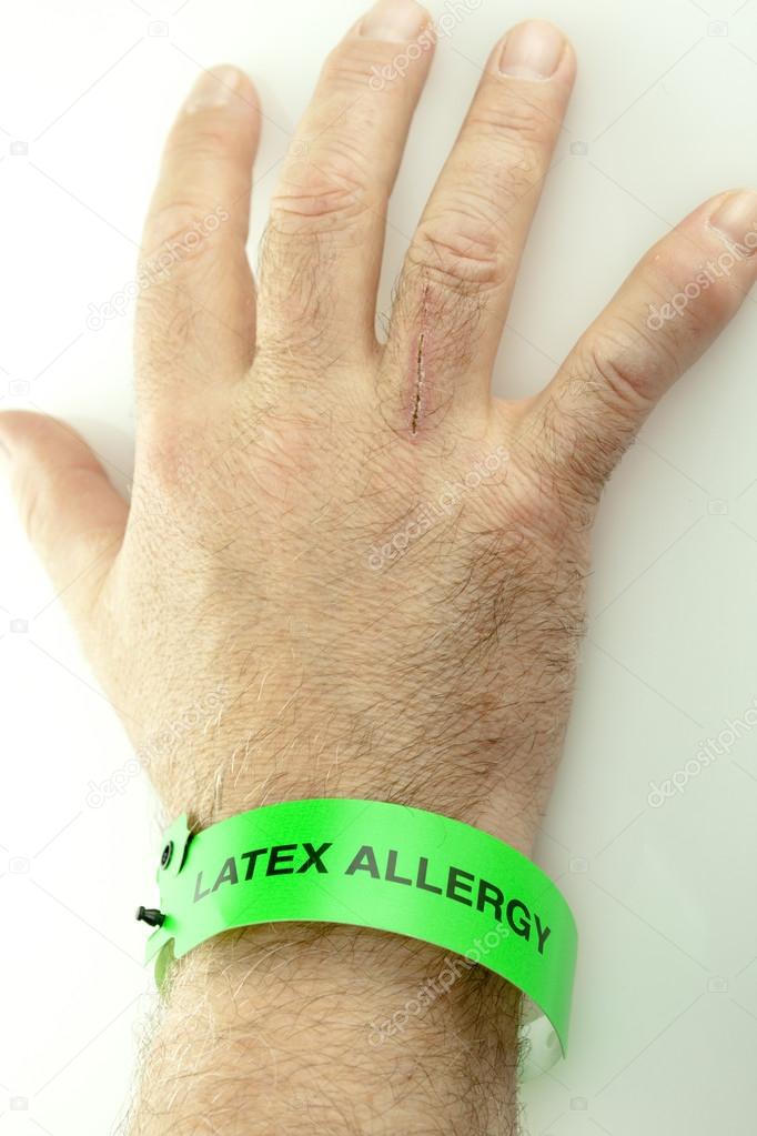 Tree Nut Allergy Wristband - Black White - Butler and Grace Ltd