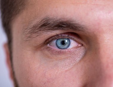 Mavi gözlü ve kontak lensli bir adam..