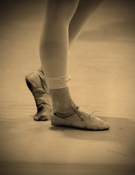 Sore and battered ballet dancer's feet — Stock Photo, Image