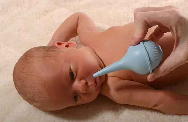 Baby and nasal aspirator — Stock Photo, Image