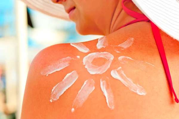 Creme protetor solar no ombro de uma mulher — Fotografia de Stock