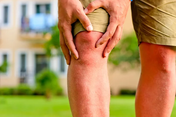 Mężczyzna, trzymając ręce ból kolana — Zdjęcie stockowe