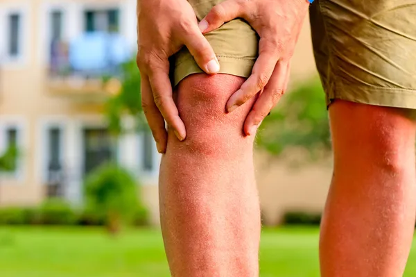 Man holding hands sore knee Stock Photo