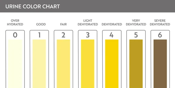 Urinen färgkarta . — Stock vektor