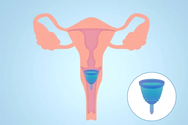 Instrucciones Sobre Cómo Usar Copa Menstrual Durante Período Sistema Reproductor — Foto de Stock