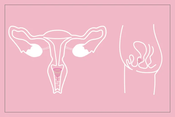 Útmutató Hogyan Kell Használni Menstruációs Csésze Időszak Alatt Női Reproduktív — Stock Fotó