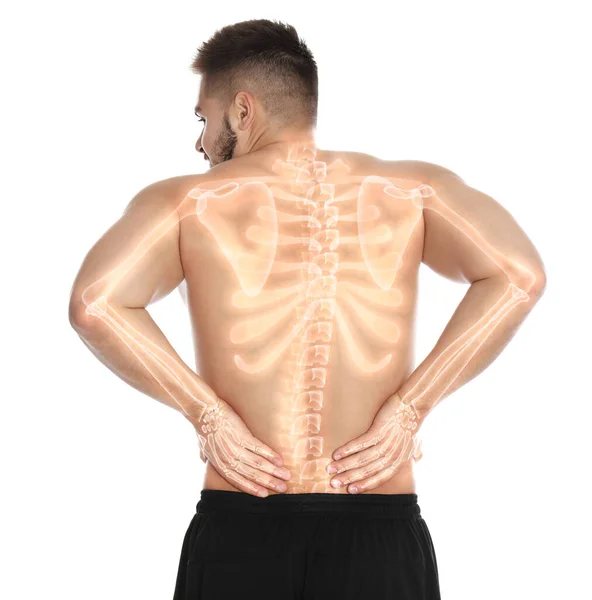 白い背景に背中を痛めている男 背骨のイラストで構成されたデジタル — ストック写真