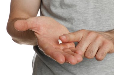 Eline krem süren bir adam beyaz arka planda tedavi görüyor, yakın plan.