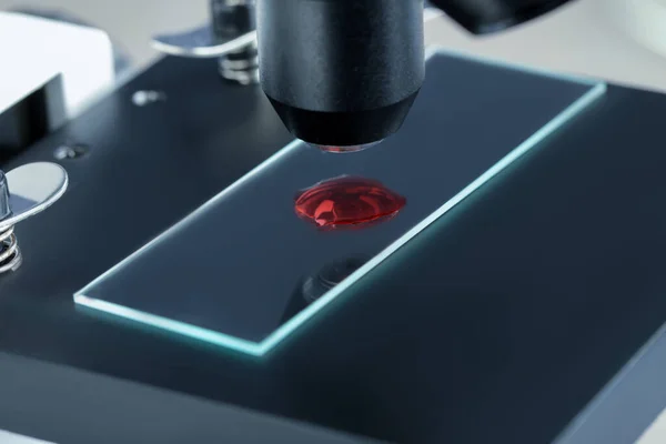 Glazen Glaasje Met Monster Van Rode Vloeistof Onder Microscoop Laboratorium — Stockfoto