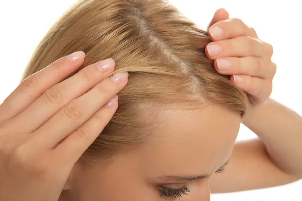 Frau Mit Haarausfall Problem Auf Weißem Hintergrund Nahaufnahme Trichologische Behandlung — Stockfoto