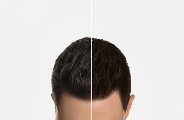 Nahaufnahme Des Mannes Vor Und Nach Dem Haarfärben Auf Hellem — Stockfoto