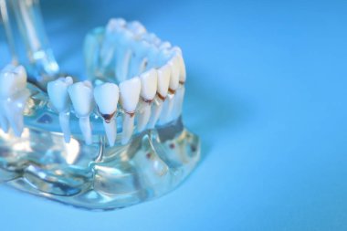 Açık mavi arka planda dişleri olan eğitici bir dişçi tipodu modeli, yakın plan. Metin için boşluk