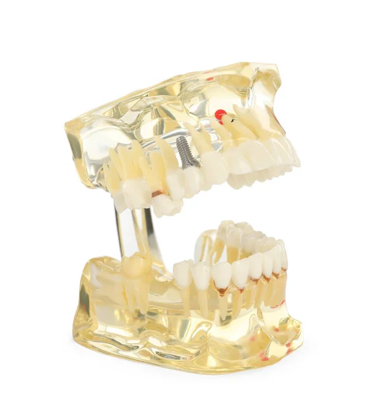 Edukacyjny Dentystyczny Typodont Model Izolowany Białym — Zdjęcie stockowe