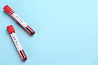 Üzerinde kan örnekleri olan tüpler ve açık mavi arka plan üzerinde STD testi. Metin için boşluk