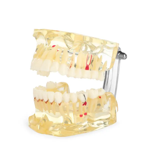 Educational Dental Typodont Model Isolated White — Stock Photo, Image