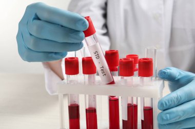 Bilim adamı kan örneğiyle tüp alıyor ve beyaz masadaki raflardan STD testi yapıyor.