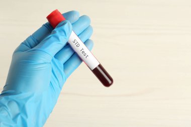 Bilim adamı, üzerinde kan örneği olan bir tüp tutuyor ve beyaz arka plan üzerinde STD testi yapıyor. Metin için boşluk