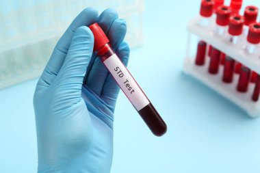 Bilim adamları üzerinde kan örneği ve STD testi olan tüpü açık mavi arkaplanda tutuyor.