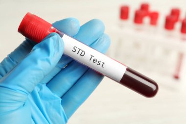Bilim adamlarının elinde kan örneği ve beyaz arkaplan üzerinde STD testi olan tüp var.
