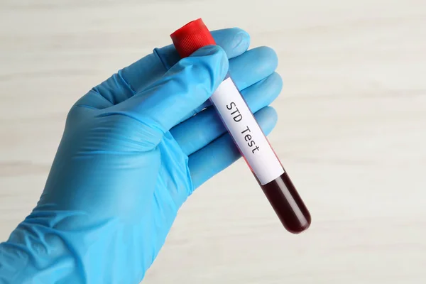 Científico Sosteniendo Tubo Con Muestra Sangre Etiqueta Std Test Sobre —  Fotos de Stock