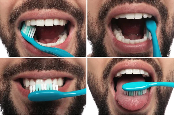 Collage Photos Man Brushing Teeth White Background Closeup Dental Care — Stock Photo, Image