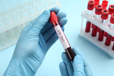 Bilim adamları üzerinde kan örneği ve STD testi olan tüpü açık mavi arkaplanda tutuyor.