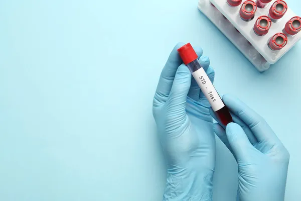 Tudósok Vérmintával Ellátott Csövet Tartanak Std Tesztet Végeznek Világoskék Háttérrel — Stock Fotó