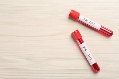 Üzerinde kan örnekleri olan tüpler ve beyaz ahşap masa üzerinde STD testi. Metin için boşluk
