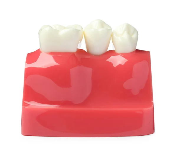 Educational Model Gum Teeth White Background — Stock Photo, Image