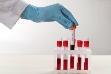 Bilim adamı kan örneğiyle tüp alıyor ve beyaz masadaki raflardan STD testi yapıyor.