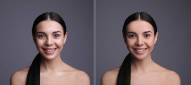 Gri arka planda eşleşen mendil kullanmadan önce ve sonra güzel genç bir kadının fotoğraflarıyla kolaj. Pankart tasarımı