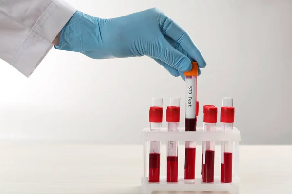 Científico Toma Tubo Con Muestra Sangre Etiqueta Ets Prueba Estante —  Fotos de Stock