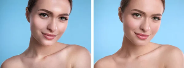 Collage Photos Beautiful Young Woman Using Mattifying Wipes Light Blue — Stock Photo, Image