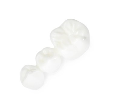 Taçları beyaza ayrılmış diş köprüsü