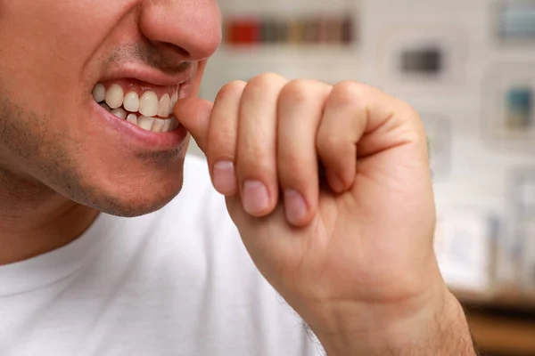 Κάποιος Τρώει Νύχια Του Εσωτερικούς Χώρους Κοντινό Πλάνο Κακή Συνήθεια — Φωτογραφία Αρχείου