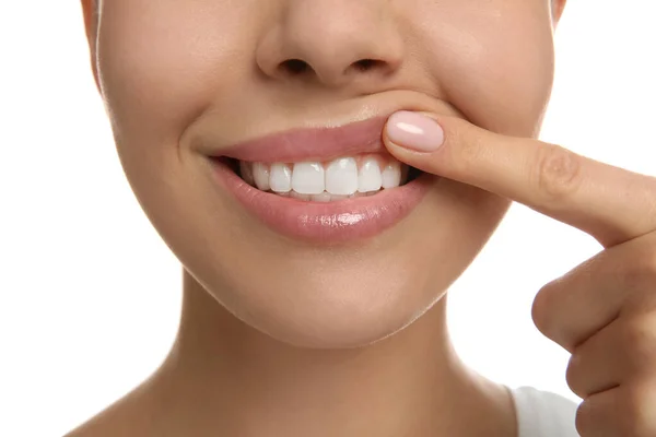 Wanita Muda Dengan Gigi Sehat Latar Belakang Putih Close — Stok Foto