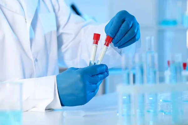 Scientist Working Samples Laboratory Closeup Medical Research — Stock Photo, Image